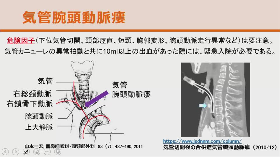 第3章 在宅における治療技術 公益財団法人 在宅医療助成 勇美記念財団